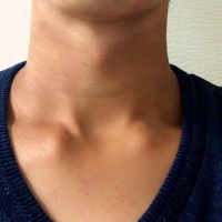 profile_image