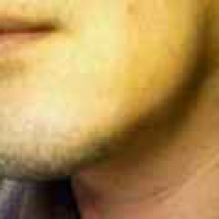 profile_image